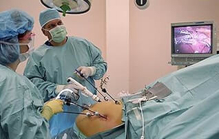 laparoscopy